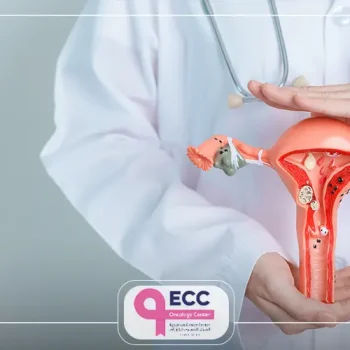 الاورام الليفية في الرحم وعلاجها