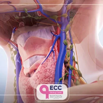 استئصال الفص الايمن من الغدة الدرقية