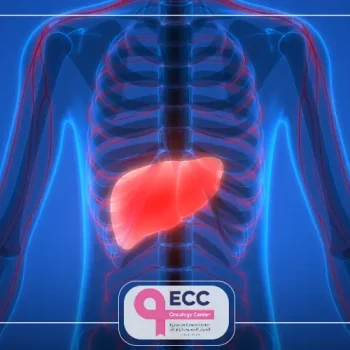 علاج سرطان الكبد المتاخر