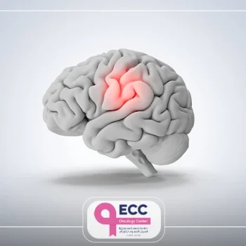 عملية استئصال ورم الدماغ الحميد