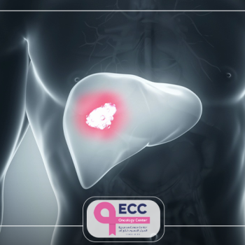 كم يعيش مريض سرطان الكبد بدون علاج