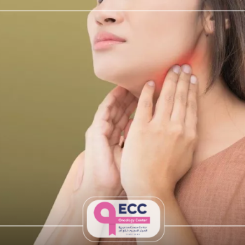 مدة علاج سرطان الغدد اللمفاوية